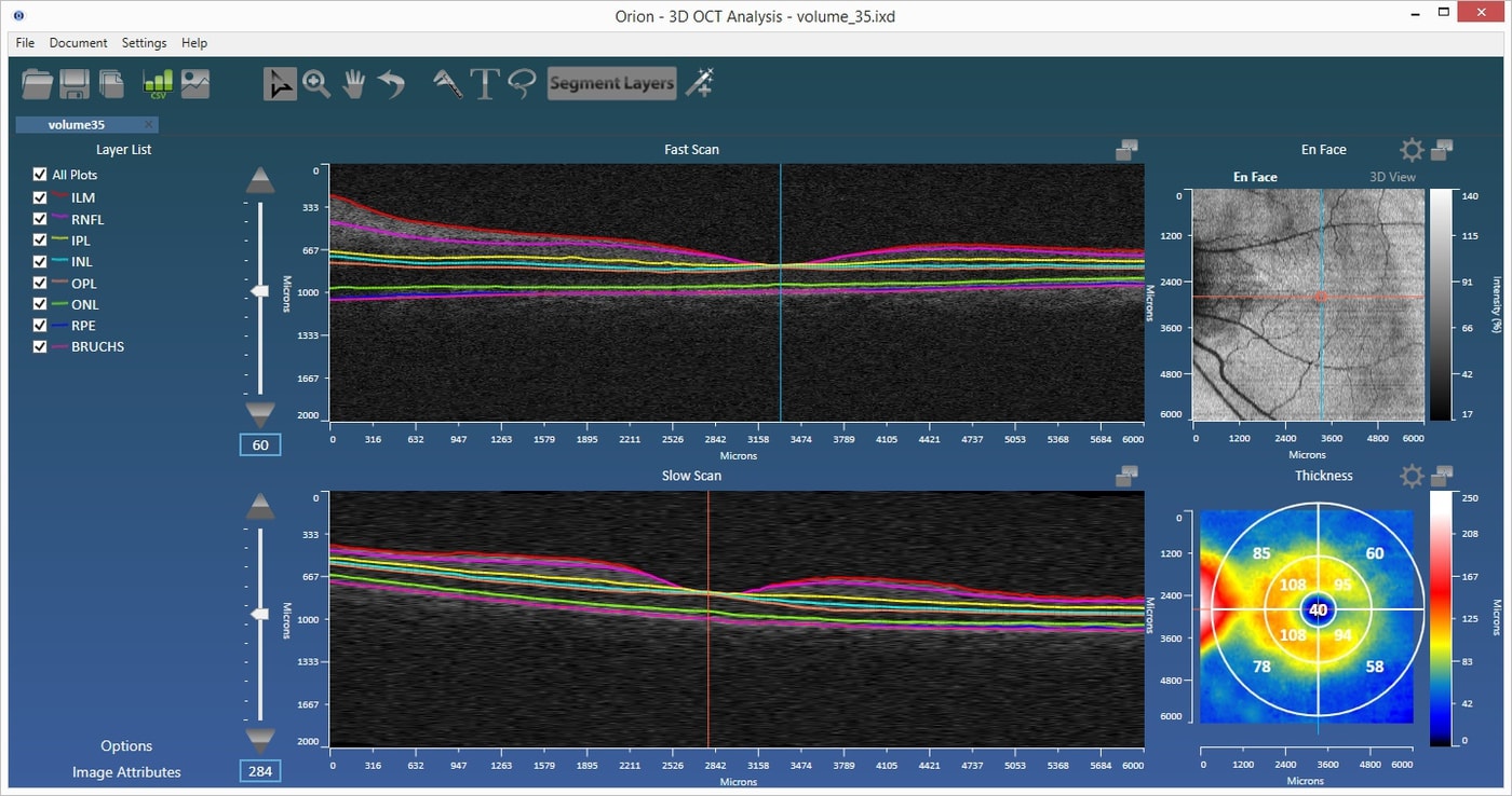 Layer Segmentation Web Page